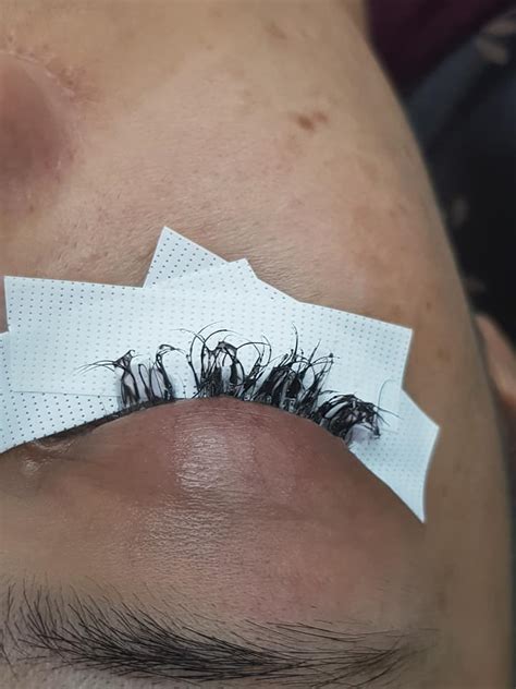 Thai Beautician Rescues Woman After Her Fake Eyelashes Were Stuck On With Super Glue