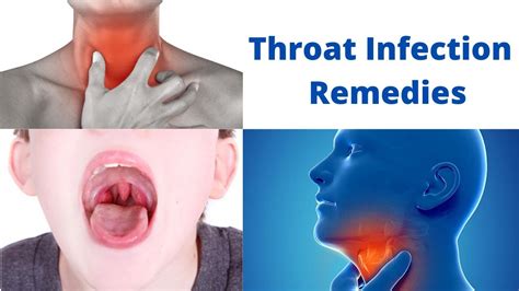 what does the throat look like