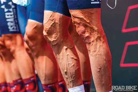 6 Best Facts About Varicose Veins For Cyclists Road Bike Action