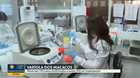Secretaria estadual de Saúde confirma 133 casos de varíola dos macacos