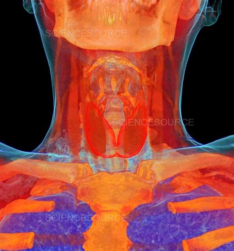 Photograph Human Neck Anatomy 3d Ct Scan Science Source Images