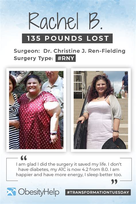 Before And After Rny With Rachel B Losing 135 Pounds Obesityhelp