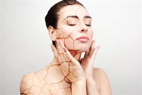 What To Do About Dry Cracked Skin In The Winter Integrated Dermatology Of Reston