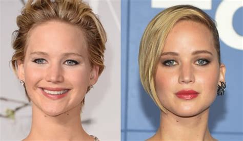 Jennifer Lawrence Before After Plastic Surgery