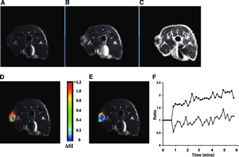 DCE MRI Monitoring Of Tumor Response To CA4P A C Conventional MR