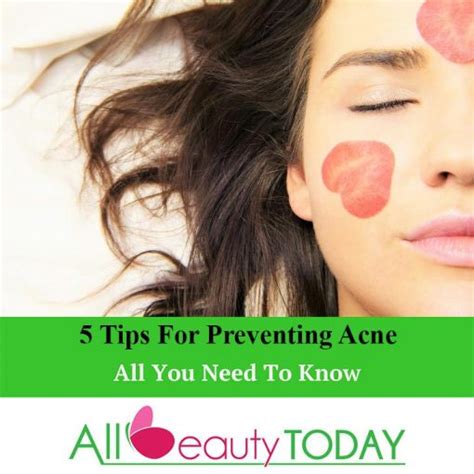 5 Tips For Preventing Acne All Beauty Today