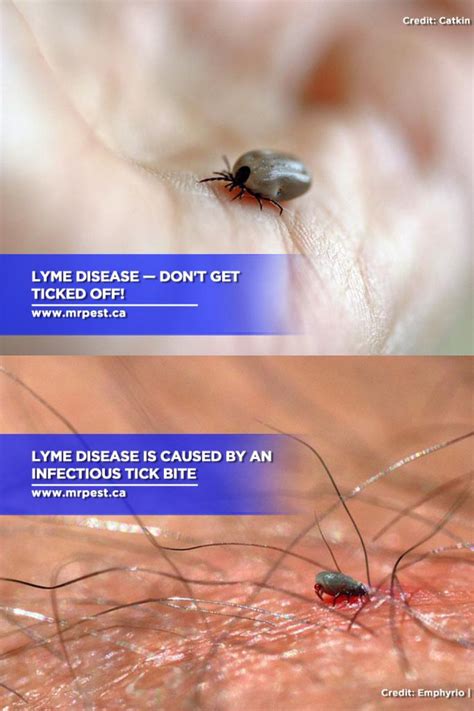 Lyme Disease Dont Get Ticked Off Lyme Disease Disease Lyme