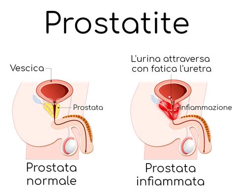 Prostata Healthy The Wom