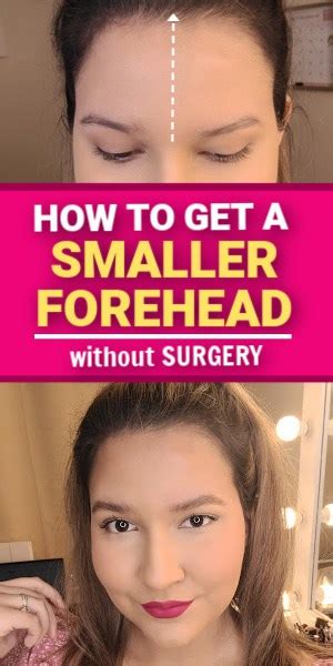 How To Make Your Forehead Smaller Without Surgery Big Forehead