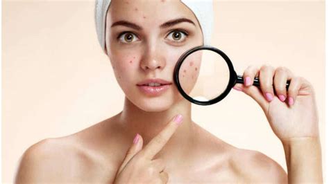 Age Spots Tvak Skin Hair And Laser Clinic