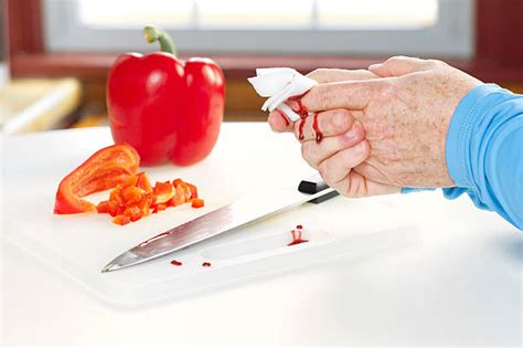 Kitchen Knife Dripping In Blood With Copy Space Stock Photos Pictures