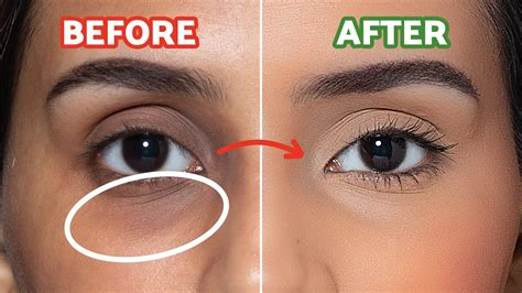 How To Make Dark Circles Disappear Hacks For Beginners Youtube