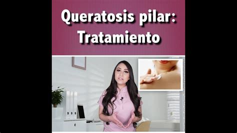 Queratosis Pilar Tratamientol Dra Pau Z Iga Clips Youtube