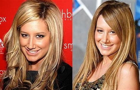 Hollywood Hot Celebrities With Plastic Surgery Cosmetic Surgery