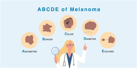 Melanoma Awareness Month Know Your Risk Overlake Medical Center