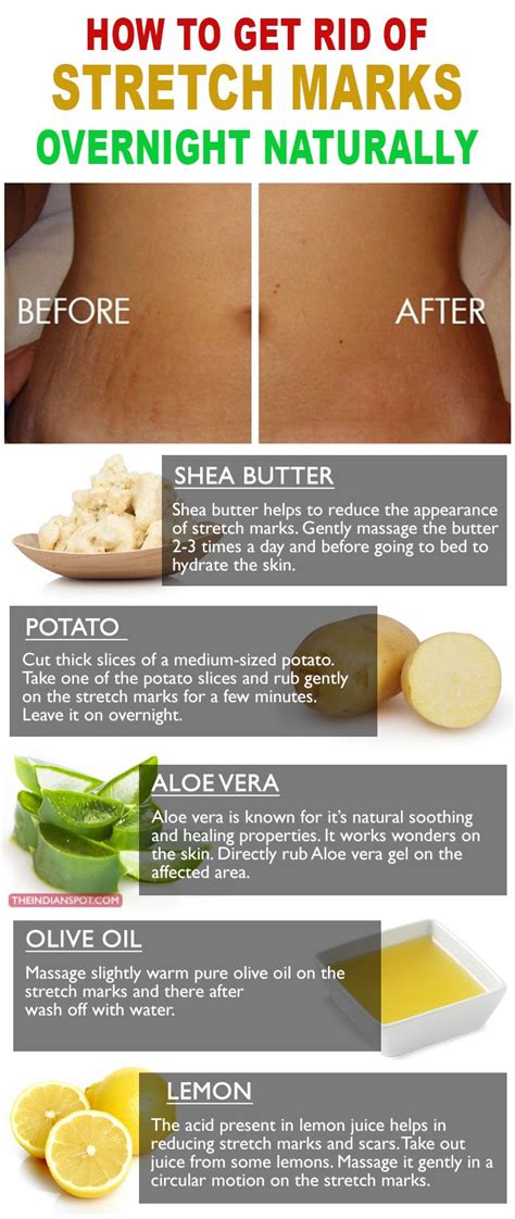 How To Remove Stretch Marks Overnight Naturally Stretch Marks Removal