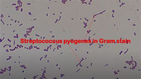 Streptococcus Pyogenes In Gram Stained Smear Of Culture Microscopy At Various Magnifications