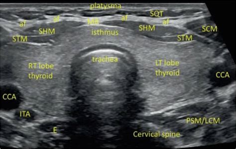 Anatomy Ultrasound Views My Endo Consult