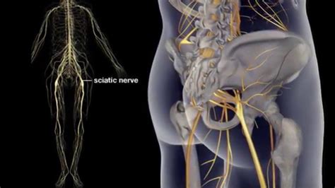 What Is Sciatic Nerve Causes Sciatic Pain Relief Treatment Sciatic