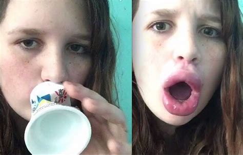 When The Kylie Jenner Lip Transformation Challenge Goes Wrong Epic Fails