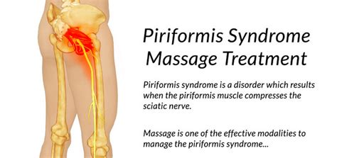 What Is Piriformis Syndrome Example Grow Health