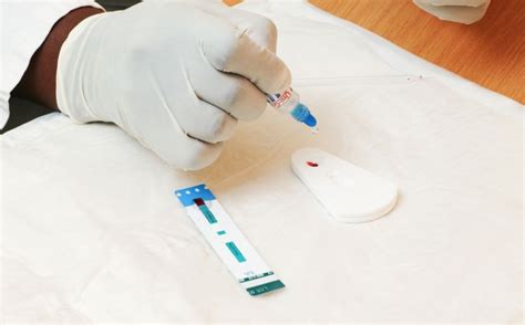 ziua de cluj testări gratuite la cluj pentru hiv sifilis hepatită b și c cum poți
