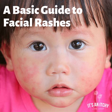 Best Treatments For Facial Rashes Its An Itchy Little World