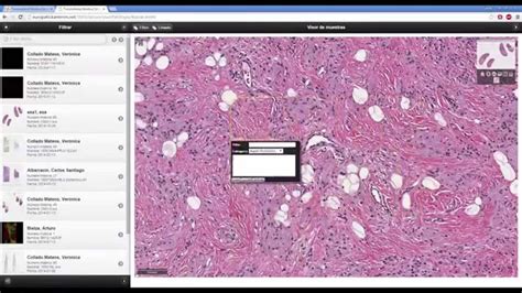 Digital Pathology Viewer Youtube