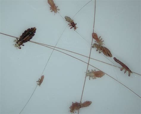 One common question about lice is whether certain populations are more or less prone to getting afflicted by lice. Get Rid of Head Lice | Dallas County, Tarrant County