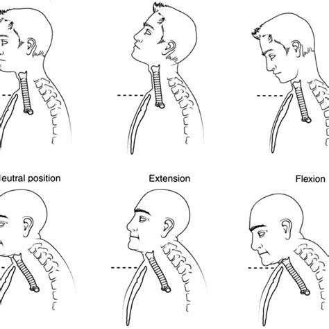 Mobility Of The Trachea With Flexion And Extension Of The Neck
