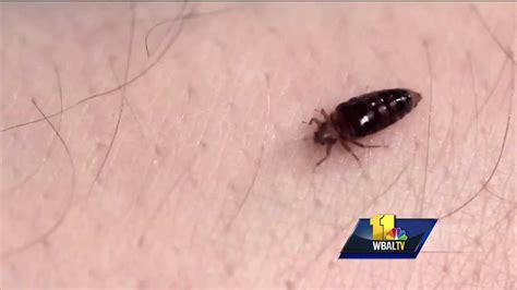 Video Baltimore Ranked Top Bed Bug City In Us