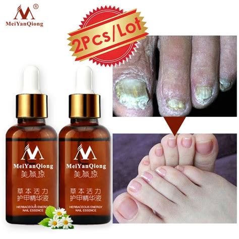 Nail Fungal Treatment Feet Care Essence Against Oils Fungus Removal Gel