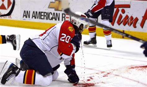 Worst Injuries In Hockey