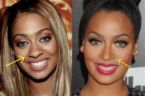 Lala Anthony S Extreme Body And Facial Transformation Famous Actress