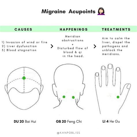 Pin On Migraine Awareness