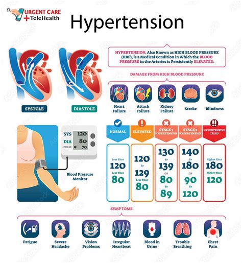 Hypertension High Blood Pressure Testing And Treatment In Napa