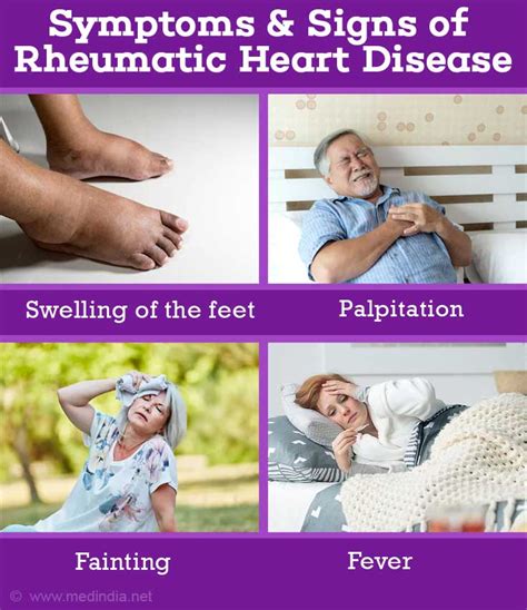 Rheumatic Heart Disease Rhd Causes Risk Factors Symptoms