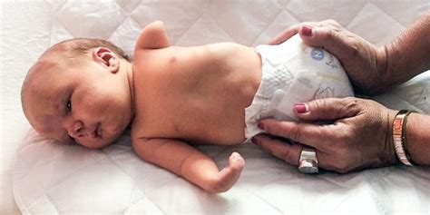 After Her Baby Was Born Without Legs And An Arm A Mother Witnessed A