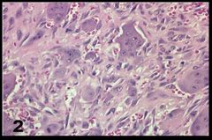 They are seen in about 4 out of 5 newborns. Oral Path Images Flashcards | Quizlet