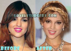 Eiza Gonzalez Plastic Surgery Before And After Photos Lovely Surgery