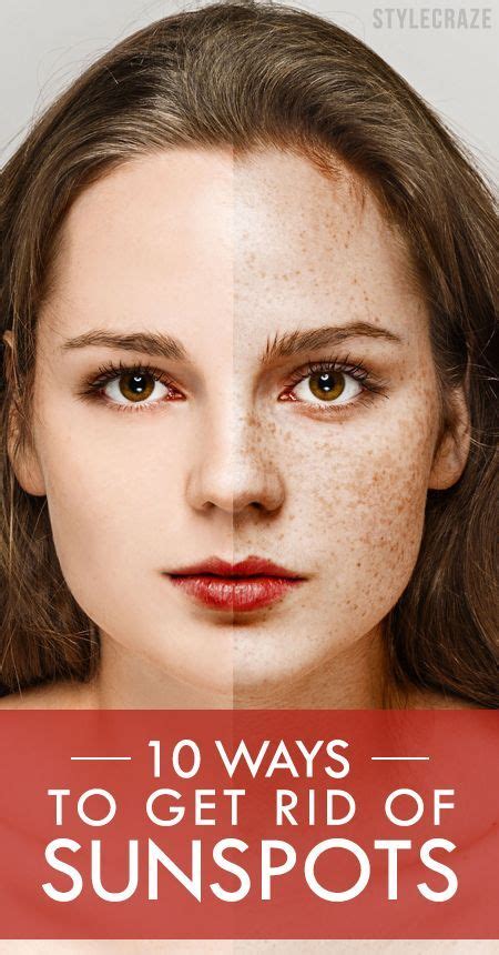 12 Simple Ways To Get Rid Of Sunspots Brown Spots On Skin Brown