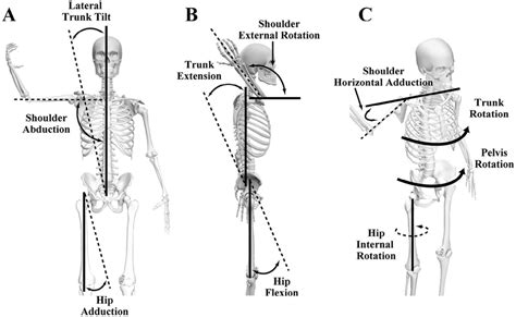 Two people now lift the patient by the dislocated arm; Definition of kinematics: (A) Lateral trunk tilt, shoulder ...