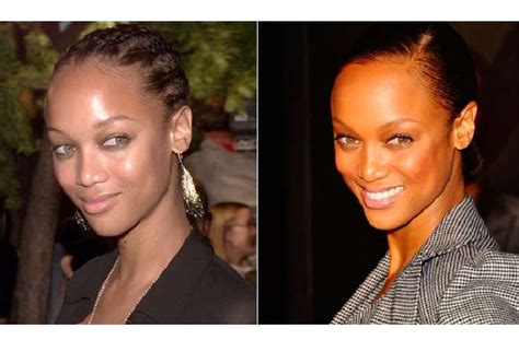 15 Trends For Haircuts For Receding Hairline Female