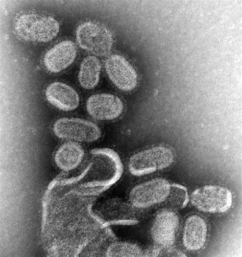 Influenza Wikipedia