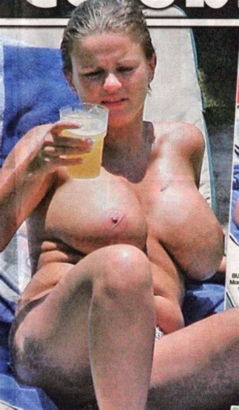Kerry Katona Topless Sunbathing Pics NudeBase Com