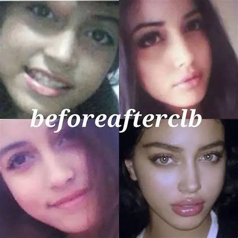 Cindy Kimberly Gets Fame A Perfect Babefriend And An Alleged Plastic Surgery At A Babe Age