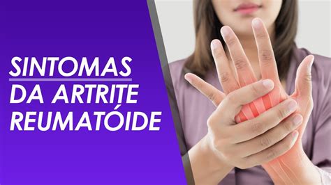 Artrite Reumatoide Causas Sintomas E Tratamentos Atualizado Riset