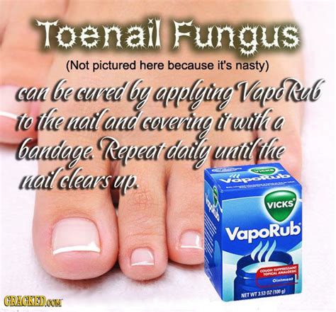 19 Home Remedies That Actually Work Toenail Fungus Remedies Nail