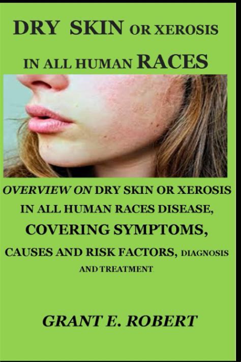Buy Dry Skin Or Xerosis In All Human Races Overview On Dry Skin Or