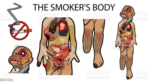 The Smokers Bodysmoking Causes Cancer Heart Disease Stroke Lung
